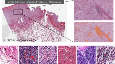 Deep Learning-Based Mapping of Tumor Infiltrating Lymphocytes in Whole Slide Images of 23 Types of Cancer